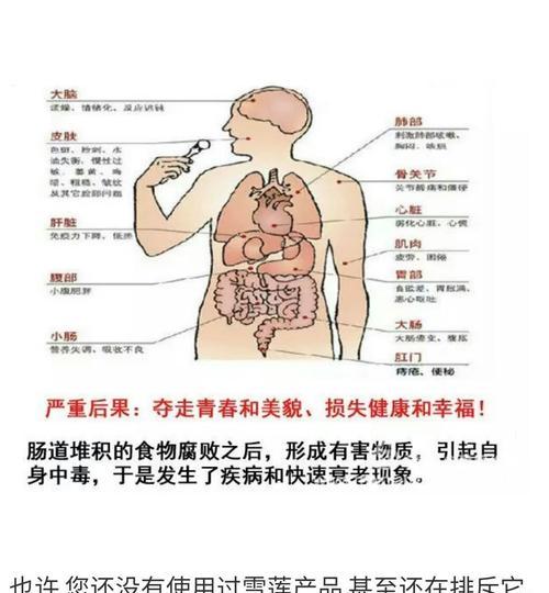 君子兰炭疽病怎么引起的？有效治疗方法有哪些？